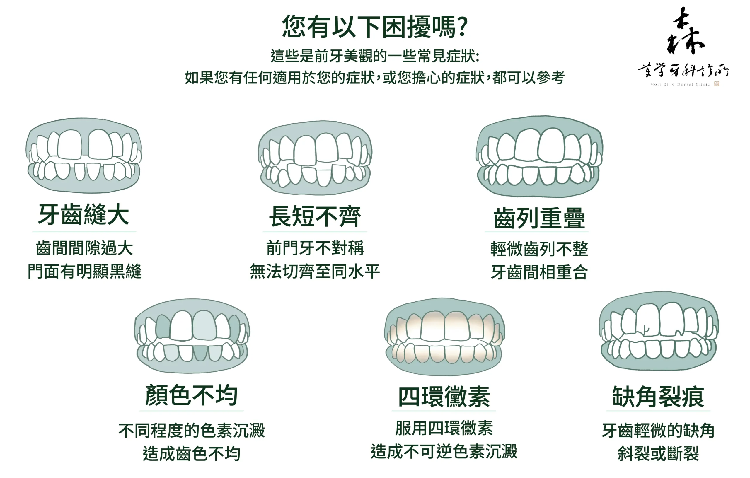 牙 齒 貼 片