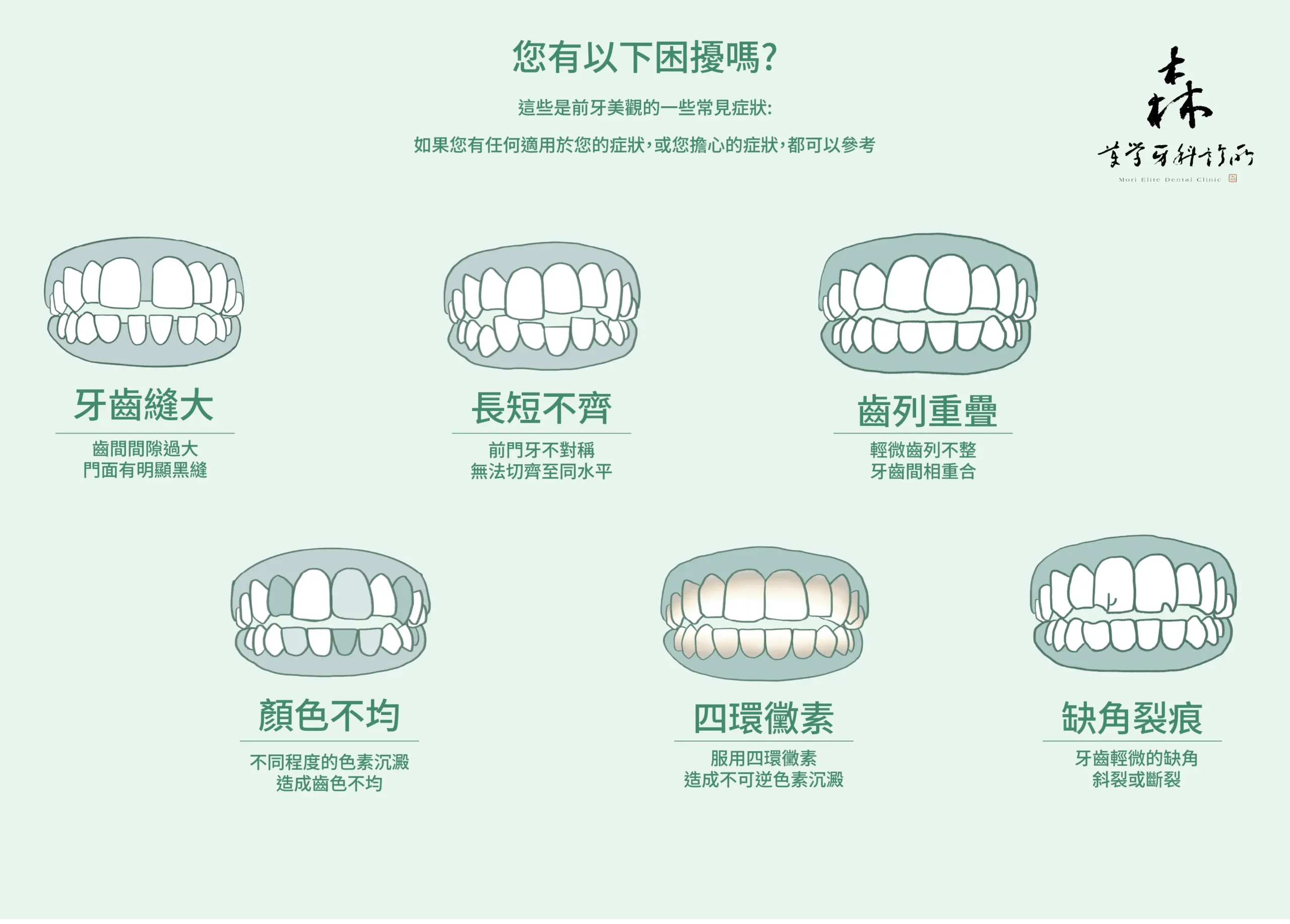 牙齒 貼片