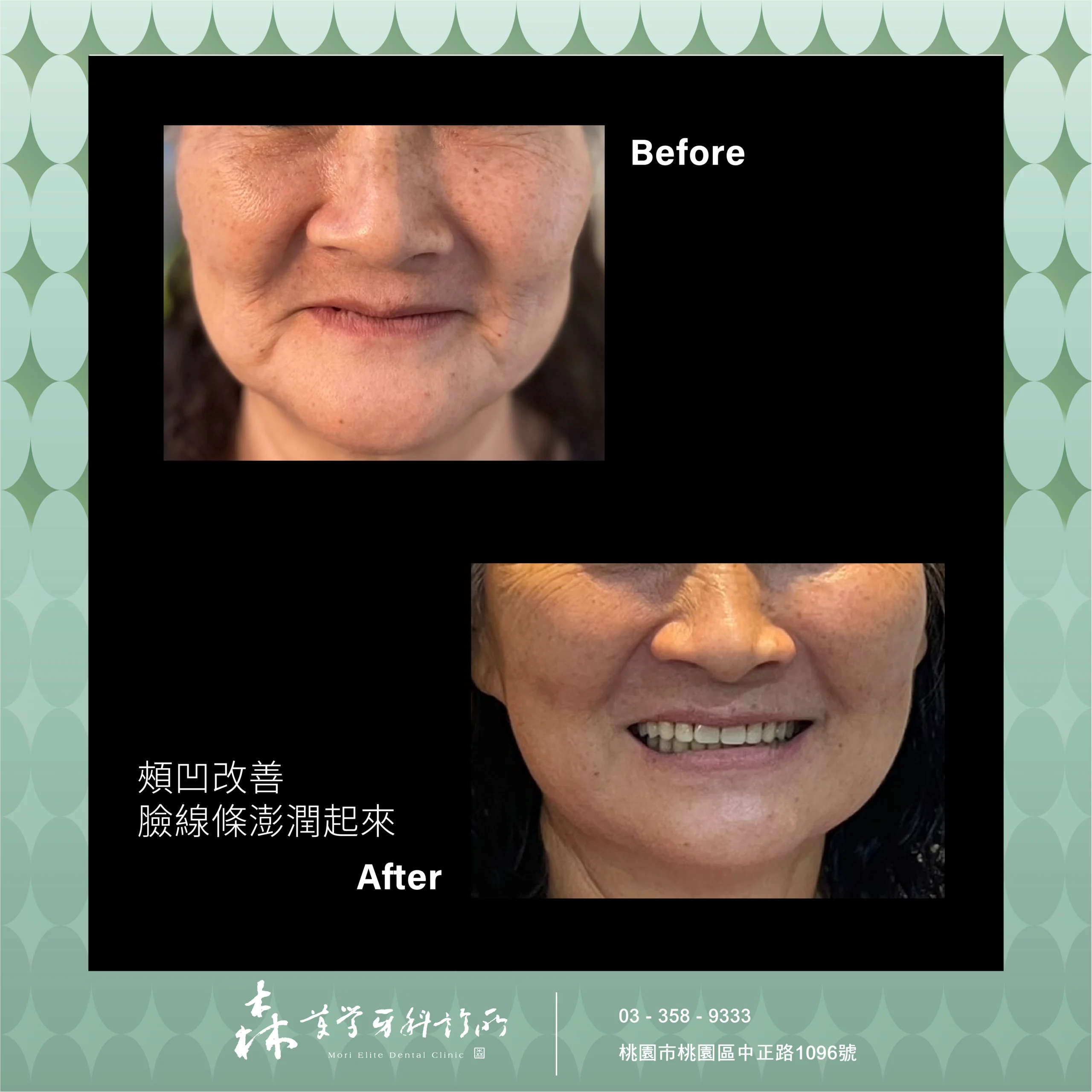 桃園隱適美推薦5