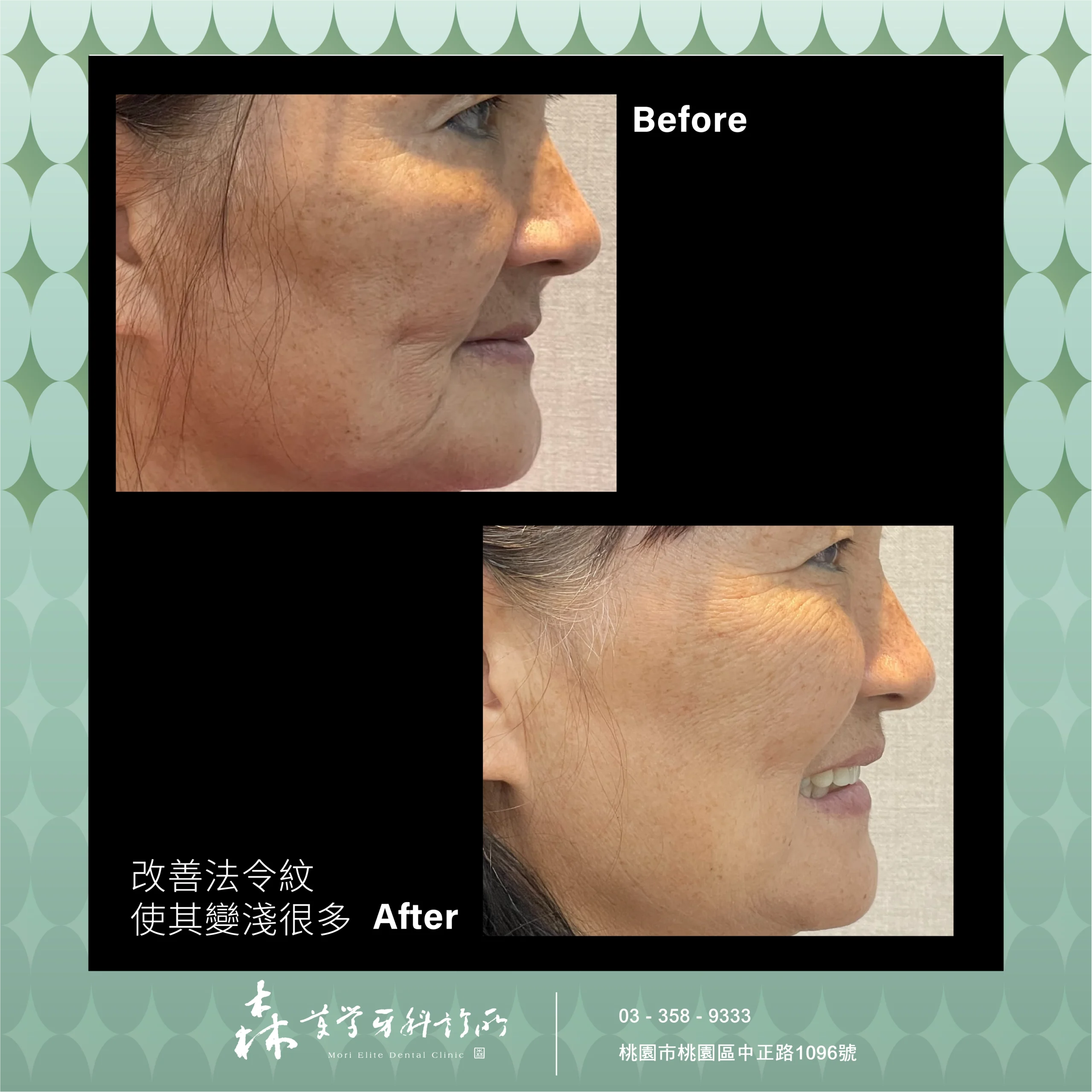 桃園隱適美推薦6