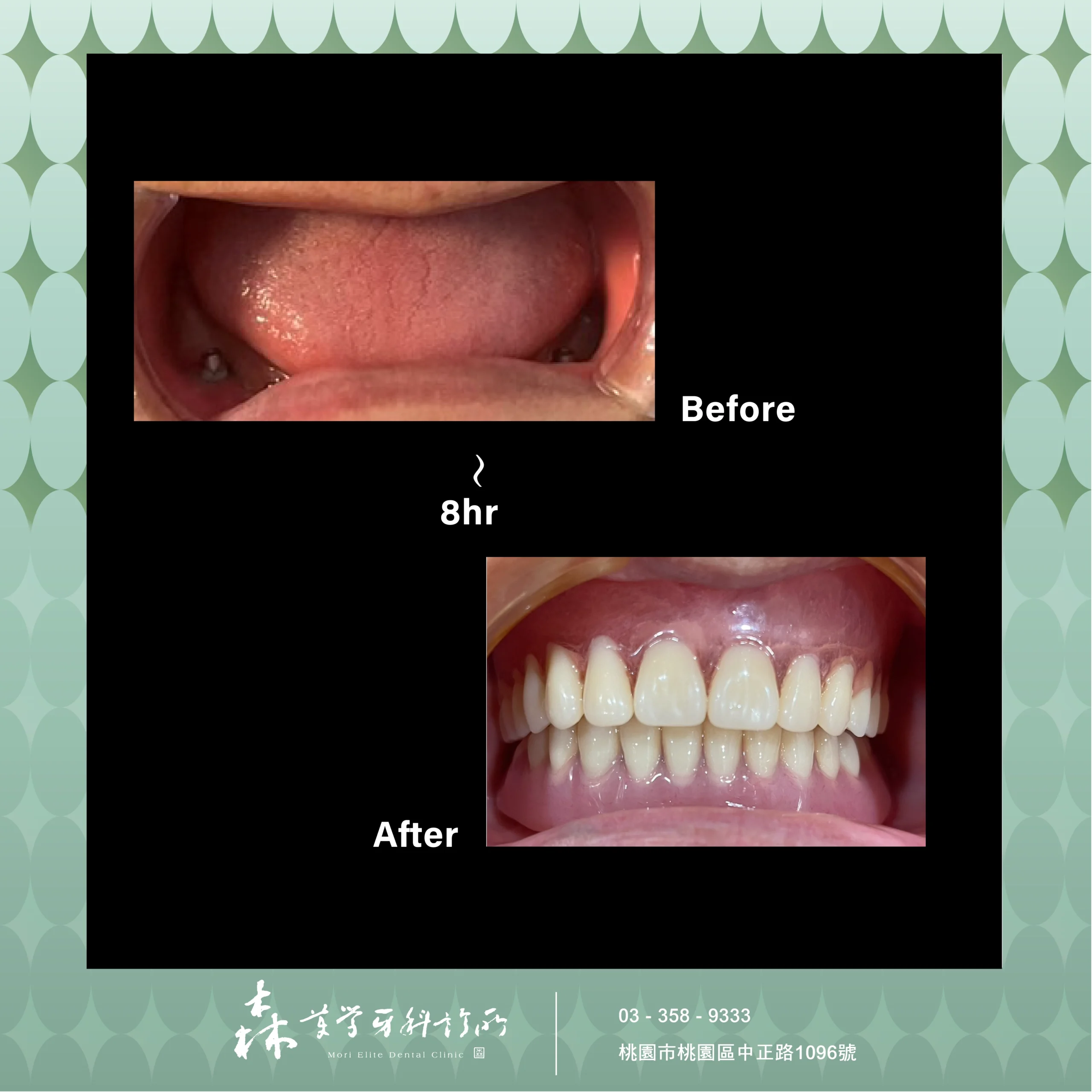 桃園隱適美推薦7