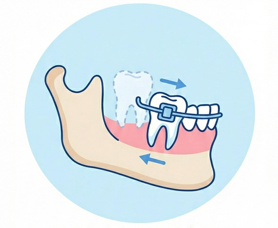 桃園牙齒矯正推薦dcard